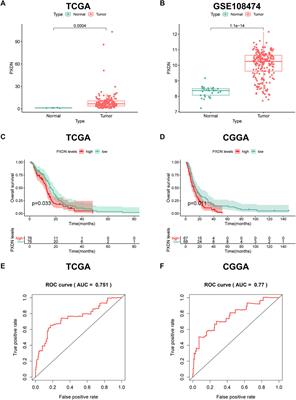 Peroxidase is a novel potential marker in glioblastoma through bioinformatics method and experimental validation